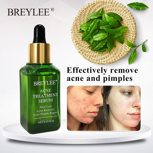 Zaverna Acne Behandelserum - productfoto